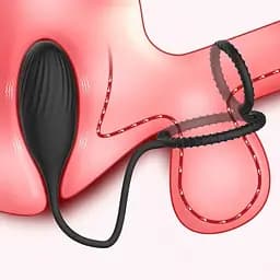 Вібратор Kinky 3 в 1: ерекційне кільце з масажером простати, вібратор для пар, віброяйце (без пульту ДК) - мініатюра 2